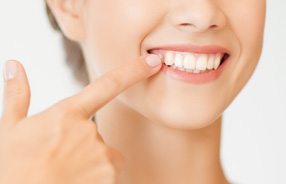 Dental composite fillings in Northridge and San Fernando Valley